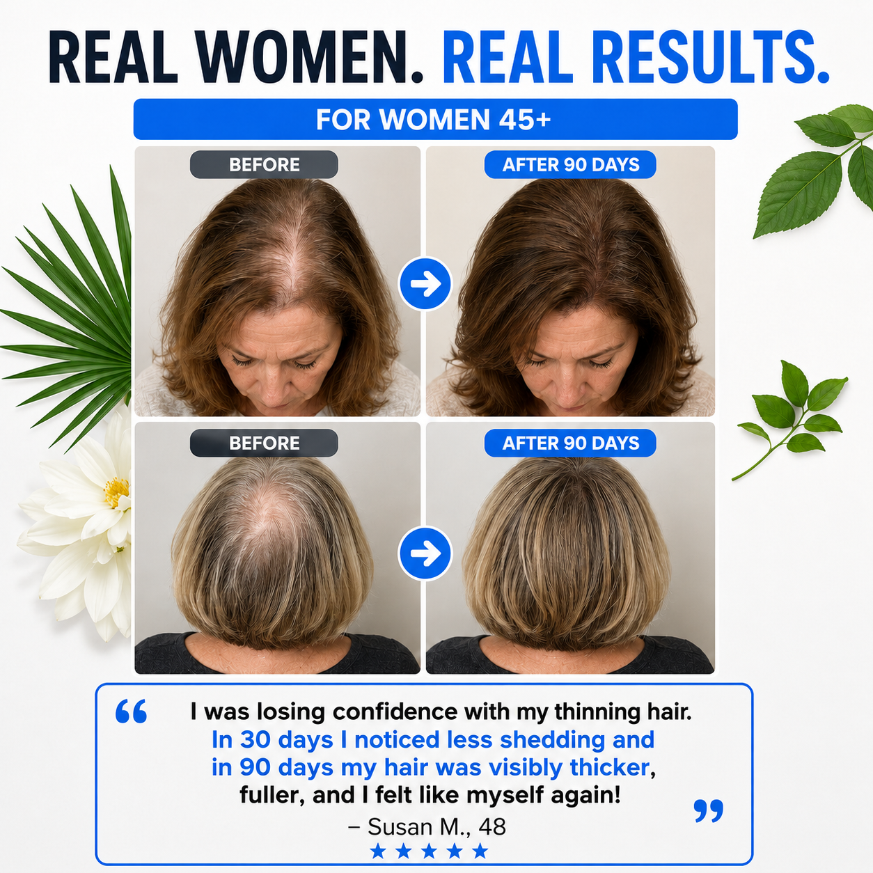 Get Your Hair & Confidence Back Within 90 Days with RootRevival+ or It's Free!